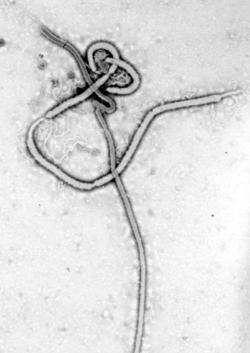 The Ebola virus. Credit: Wikimedia Commons.