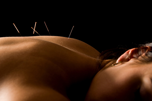 Acupuncture treatments proven successful