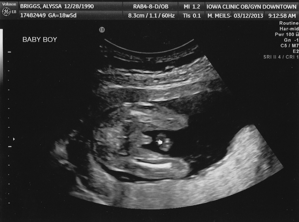 We're having a boy! — RILEY BRIGGS: design + photography